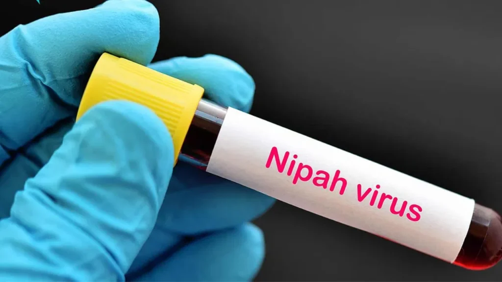 another death from nipah virus