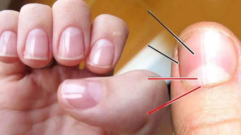 Fingernail Lunula Meaning: नाखूनों पर बने सफेद अर्धचंद्र से जानें अपना भविष्य और भाग्य Fingernail Lunula Meaning